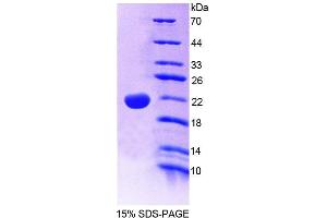 SDS-PAGE analysis of Human PTPN13 Protein. (PTPN13 蛋白)