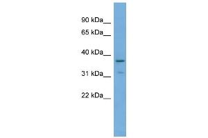 WB Suggested Anti-TOB1 Antibody Titration: 0. (Protein Tob1 (TOB1) (Middle Region) 抗体)