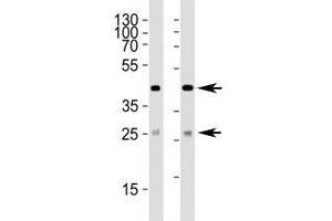 Western blot analysis of lysate from (1) 293 and (2) HepG2 cell line using SIRT3 antibody at 1:1000. (SIRT3 抗体  (AA 250-279))