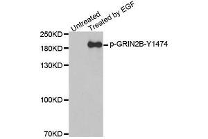 Western blot analysis of extracts from A431 cells, using Phospho-GRIN2B-Y1474 antibody (ABIN2988034). (GRIN2B 抗体  (pTyr1474))