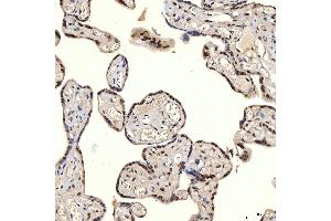 IHC analysis of U1A/SNRPA using anti-U1A/SNRPA antibody (ABIN7600891). (SNRPA1 抗体  (AA 25-218))
