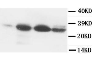 Western Blotting (WB) image for anti-B-Cell CLL/lymphoma 2 (BCL2) (AA 41-54) antibody (ABIN1105504) (Bcl-2 抗体  (AA 41-54))