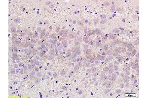 Formalin-fixed and paraffin embedded rat brain labeled with Anti- NCX2/SLC8A2 Polyclonal Antibody, Unconjugated (ABIN676478) at 1:200 followed by conjugation to the secondary antibody and DAB staining (SLC8A2 抗体  (AA 601-700))