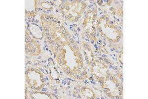 Immunohistochemistry of paraffin-embedded human kidney using DCTN2 antibody at dilution of 1:200 (x40 lens) (Dynamitin 抗体)
