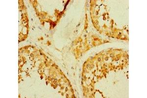 Immunohistochemistry of paraffin-embedded human testis tissue using ABIN7172741 at dilution of 1:100 (TADA2B 抗体  (AA 29-328))