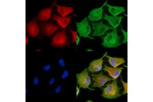 ABIN6262683 and ABIN6278907 staining  cells by IF/ICC. (ITGA8 抗体  (C-Term))