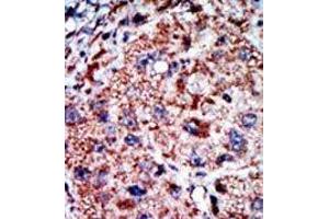 Image no. 2 for anti-Phosphofructokinase, Liver (PFKL) (C-Term) antibody (ABIN360629) (PFKL 抗体  (C-Term))