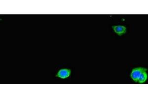 Immunofluorescent analysis of HepG2 cells using ABIN7171544 at dilution of 1:100 and Alexa Fluor 488-congugated AffiniPure Goat Anti-Rabbit IgG(H+L) (TAS2R38 抗体  (AA 212-251))