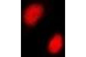 Immunofluorescent analysis of CGBP staining in A549 cells. (CXXC1 抗体)