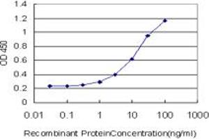 Detection limit for recombinant GST tagged ESR2 is approximately 0. (ESR2 抗体  (AA 22-121))