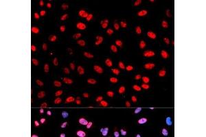 Immunofluorescence analysis of U2OS cells using Phospho-ESPL1(S1126) Polyclonal Antibody (Separase 抗体  (pSer1126))