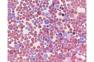 Immunohistochemistry (IHC) image for anti-ATP-Binding Cassette, Sub-Family C (CFTR/MRP), Member 5 (ABCC5) antibody (ABIN920695) (ABCC5 抗体)