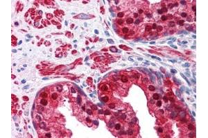 Human Prostate: Formalin-Fixed, Paraffin-Embedded (FFPE) (Isocitrate Dehydrogenase 抗体)