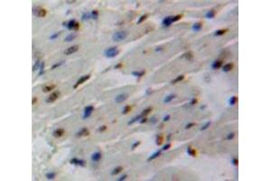 Used in DAB staining on fromalin fixed paraffin-embedded Heart tissue (SMAD6 抗体  (AA 116-364))