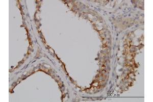 Immunostaining (ISt) image for anti-gamma Glutamyltransferase 1 (GGT1) (AA 381-470) antibody (ABIN561038)