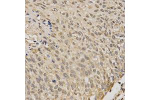 Immunohistochemistry (IHC) image for anti-serine/threonine Kinase 11 (STK11) (AA 134-433) antibody (ABIN3022973) (LKB1 抗体  (AA 134-433))