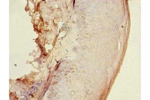 Immunohistochemistry of paraffin-embedded human skin tissue using ABIN7154963 at dilution of 1:100 (HEMK1 抗体  (AA 1-338))