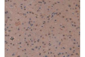 IHC-P analysis of Mouse Cerebrum Tissue, with DAB staining. (MT3 抗体  (AA 1-68))