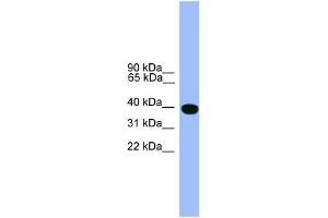 Western Blotting (WB) image for anti-serpin Peptidase Inhibitor, Clade A (Alpha-1 Antiproteinase, Antitrypsin), Member 1 (SERPINA1) (C-Term) antibody (ABIN2787988)
