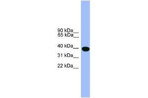 WB Suggested Anti-SERPINA1 Antibody Titration: 0. (SERPINA1 抗体  (C-Term))