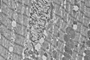 Immunoelectron microscopy analysis of LR white resin-embedded mouse heart using alpha Actinin 2 (ABIN7075510) at dilution of 1: 50. (Sarcomeric alpha Actinin 抗体)