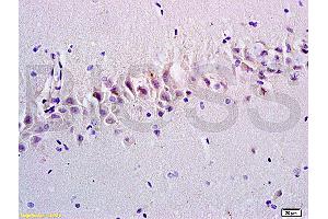 Formalin-fixed and paraffin embedded rat brain tissue labeled with Anti-Emp1/MUC1 Polyclonal Antibody, Unconjugated at 1:200, followed by conjugation to the secondary antibody and DAB staining (EMP1 抗体  (AA 101-160))