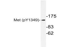 Western blot (WB) analyzes of p-Met antibody in extracts from HepG2 cells. (c-MET 抗体  (pTyr1349))