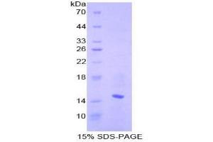 SDS-PAGE analysis of Mouse CCL6 Protein. (MRP1 蛋白)