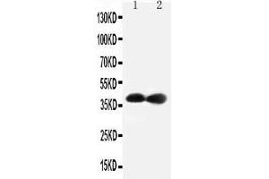 Anti-Cdk7 antibody, Western blotting Lane 1: Rat Testis Tissue Lysate Lane 2: Rat Ovary Tissue Lysate (CDK7 抗体  (C-Term))