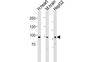 All lanes : Anti-PROX1 Antibody (Center) at 1:1000 dilution Lane 1: human heart lysates Lane 2: mouse brain lysates Lane 3: HepG2 whole cell lysates Lysates/proteins at 20 μg per lane. (PROX1 抗体  (AA 444-478))