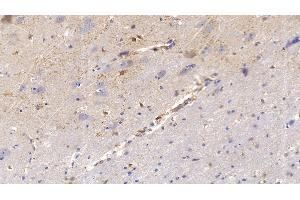 Detection of MMP2 in Human Cerebrum Tissue using Polyclonal Antibody to Matrix Metalloproteinase 2 (MMP2) (MMP2 抗体  (AA 110-660))
