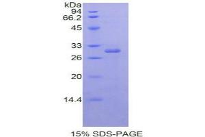 SDS-PAGE analysis of Human RORa Protein. (RORA 蛋白)