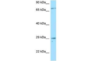 Western Blotting (WB) image for anti-Tumor Necrosis Factor Receptor Superfamily, Member 13B (TNFRSF13B) (N-Term) antibody (ABIN2789582) (TACI 抗体  (N-Term))