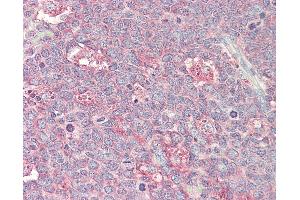 Anti-p21-ARC / ARPC3 antibody IHC staining of human tonsil. (ARPC3 抗体  (FITC))