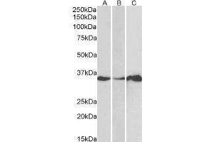 ABIN184658 (1µg/ml) staining of Human Cerebellum (A), Colon (B) and Duodenum (C) lysate (35µg protein in RIPA buffer). (LASP1 抗体  (N-Term))