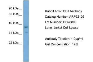 WB Suggested Anti-TOB1  Antibody Titration: 0. (Protein Tob1 (TOB1) (Middle Region) 抗体)