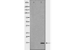 Western blot analysis of K562 whole cell lysates, using GYPC Antibody. (CD236/GYPC 抗体  (Internal Region))