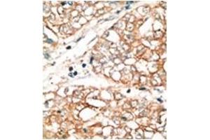 Image no. 2 for anti-BCL2-Related Ovarian Killer (BOK) (BH3 Domain), (N-Term) antibody (ABIN356820) (BOK 抗体  (BH3 Domain, N-Term))