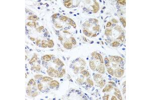 Immunohistochemistry of paraffin-embedded human stomach using ACP1 antibody at dilution of 1:100 (x40 lens). (ACP1 抗体)