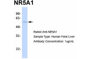 Western Blotting (WB) image for anti-Nuclear Receptor Subfamily 5, Group A, Member 1 (NR5A1) (Middle Region) antibody (ABIN2777447)