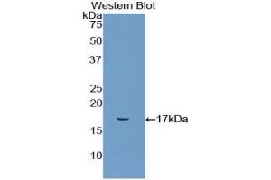 Detection of Recombinant CD72, Rat using Polyclonal Antibody to Cluster Of Differentiation 72 (CD72) (CD72 抗体  (AA 126-237))