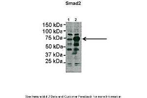 Lanes:   Lane1: 2ug HEK293lysate Lane2: 2ug SMAD2 transfected HEK293 lysate  Primary Antibody Dilution:   1:1000  Secondary Antibody:   Anti-rabbit HRP  Secondary Antibody Dilution:   1:5000  Gene Name:   SMAD2  Submitted by:   Dominique Alfandari, University of Massachusetts (SMAD2 抗体  (N-Term))