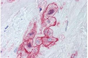 Human Placenta (formalin-fixed, paraffin-embedded) stained with MCAM antibody ABIN462314 followed by biotinylated goat anti-rabbit IgG secondary antibody ABIN481713, alkaline phosphatase-streptavidin and chromogen. (MCAM 抗体  (Tyr641))