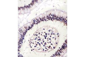 (ABIN6243085 and ABIN6578223) staining CTCF in human colon tissue sections by Immunohistochemistry (IHC-P - paraformaldehyde-fixed, paraffin-embedded sections). (CTCF 抗体  (AA 334-364))