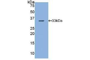 Detection of Recombinant ARRb1, Human using Polyclonal Antibody to Arrestin Beta 1 (ARRb1) (beta Arrestin 1 抗体  (AA 3-246))