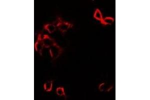Immunofluorescent analysis of GFRA1 staining in SW480 cells. (GFRA1 抗体)