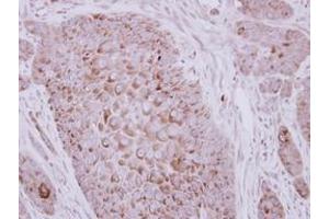 Image no. 1 for anti-Zona Pellucida Glycoprotein 2 (ZP2) (AA 1-313) antibody (ABIN1501855) (ZP2 抗体  (AA 1-313))
