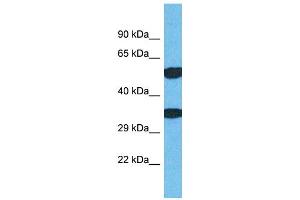 Host: Rabbit Target Name: TMEM68 Sample Type: Jurkat Whole Cell lysates Antibody Dilution: 1. (TMEM68 抗体  (N-Term))