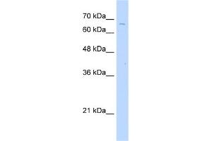 WB Suggested Anti-TKTL2 Antibody Titration:  2. (TKTL2 抗体  (C-Term))