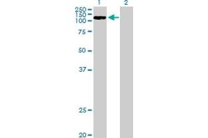 Western Blot analysis of CCDC66 expression in transfected 293T cell line by CCDC66 MaxPab polyclonal antibody. (CCDC66 抗体  (AA 1-831))